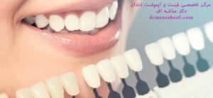 دندانپزشکی زیبایی ونیر
