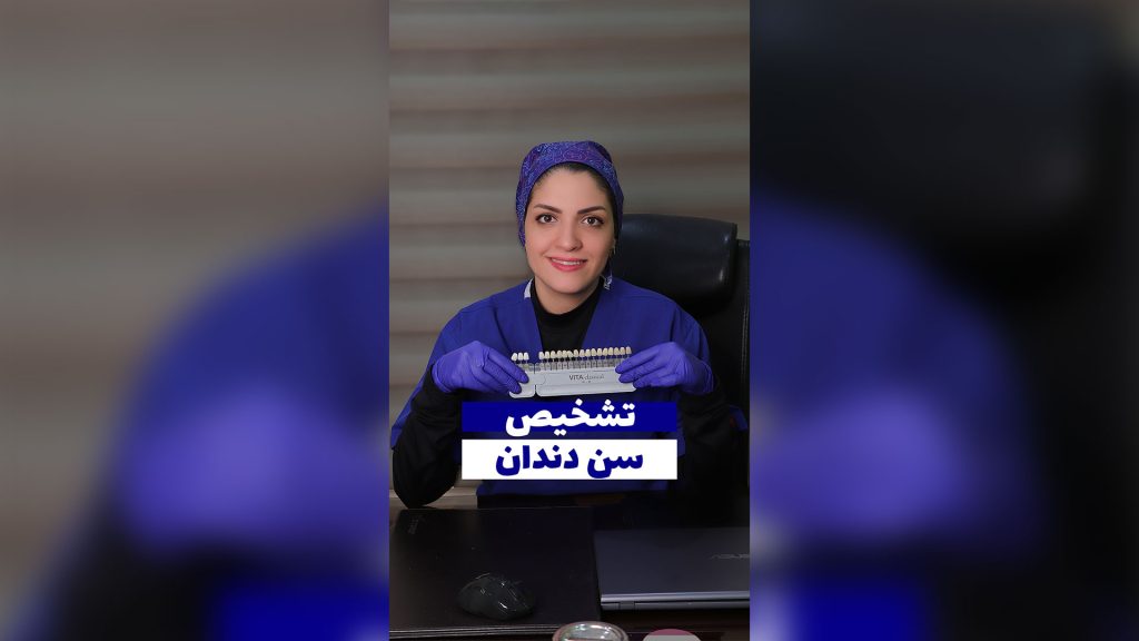 تاثیر لمینت بر زیبایی چهره