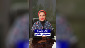 چای و قهوه سفیدی دندان