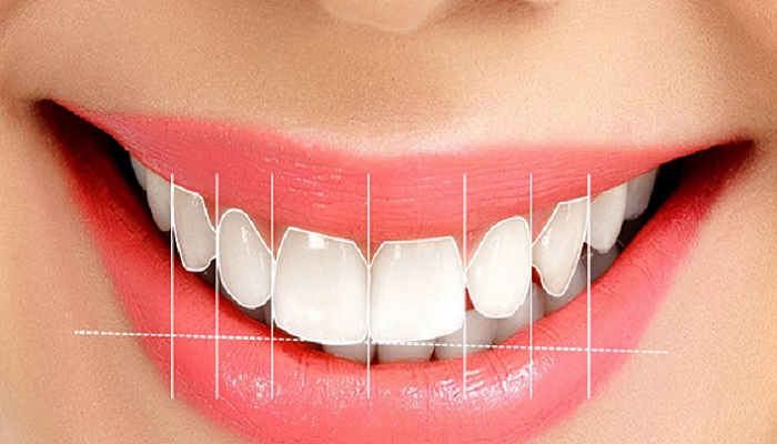 انواع طرح لبخند