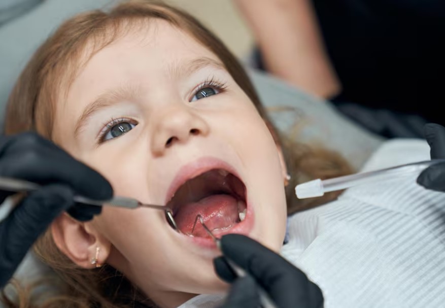 پوسیدگی زودرس دندان شیری (ECC) چیست؟